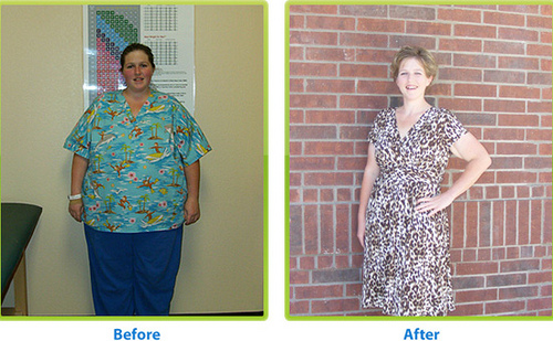 HCG Diet Before and After Photos
