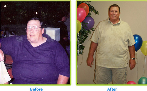 HCG Diet Before and After Photos